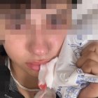 heridas provocadas por una agresión homófoba en Valladolid