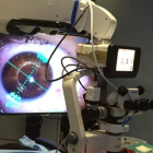 Una imagen de archivo de una cirugía de retina