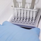 Muestras de un laboratorio.